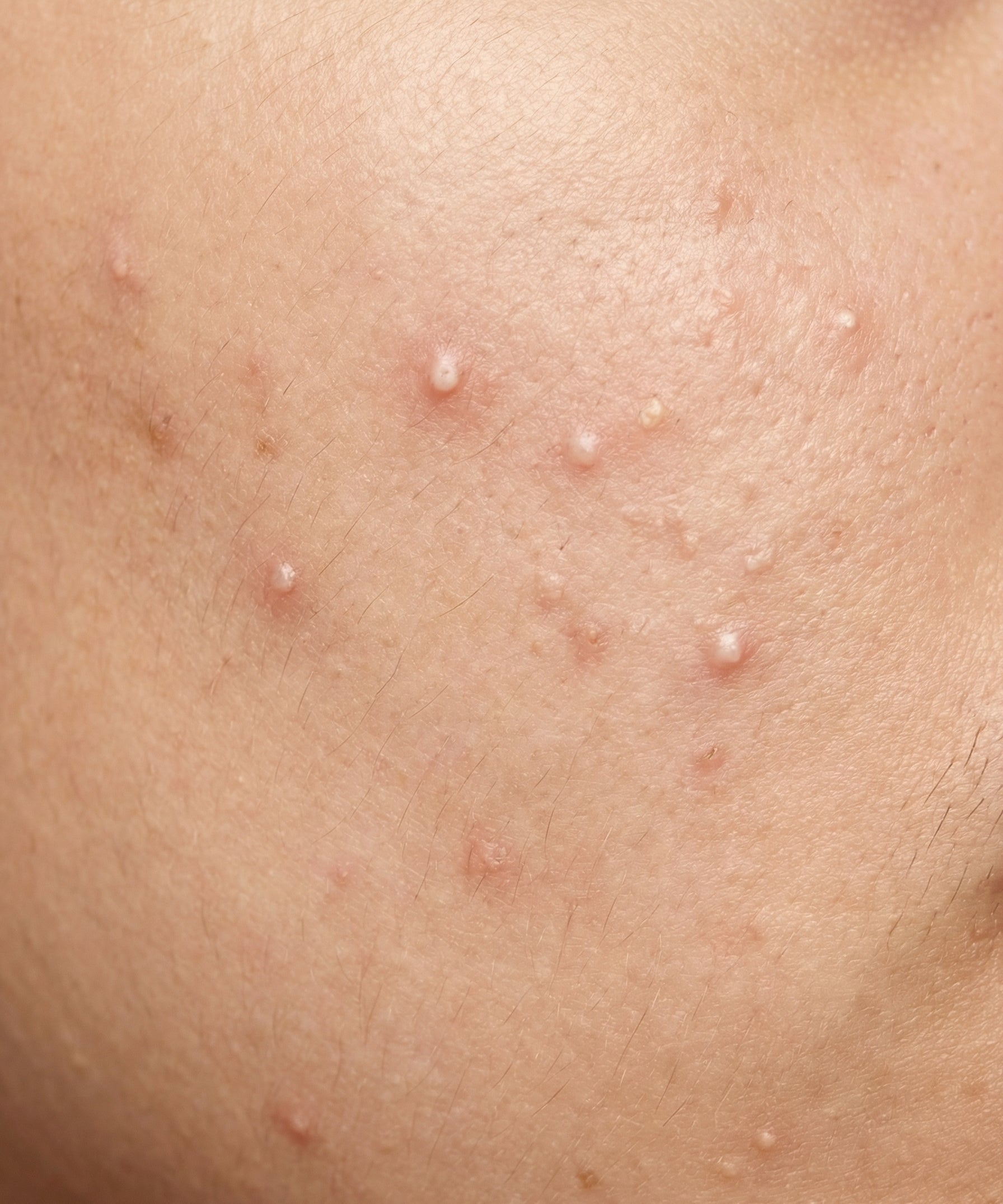 Skin_Concern1.jpg