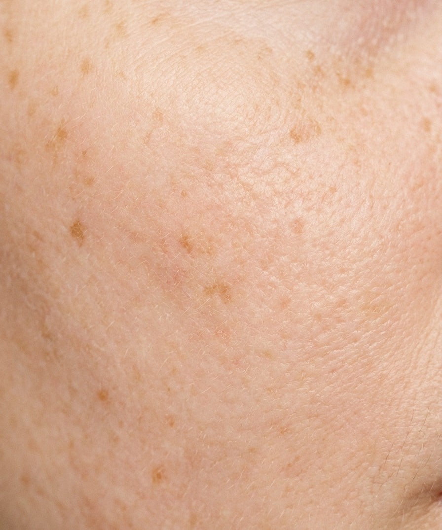 Skin_Concern3.jpg