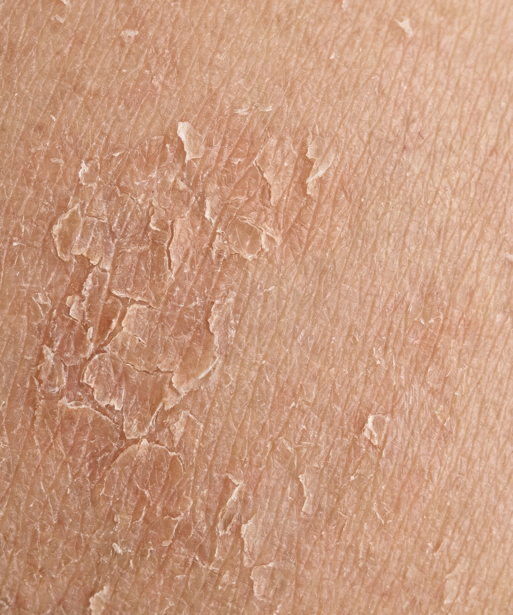 Skin_Concern4.jpg