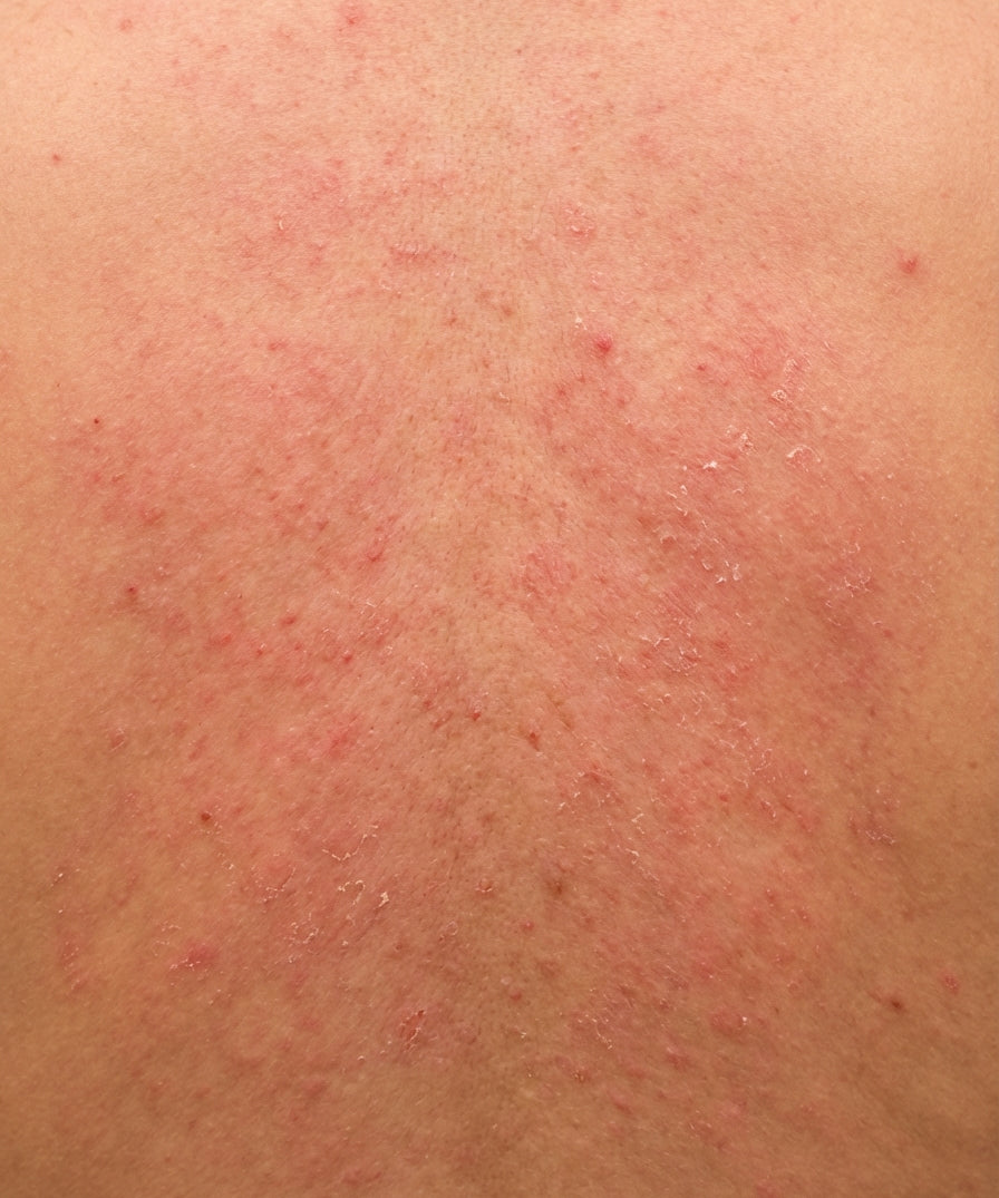 Skin_Concern6.jpg