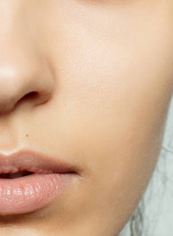 Skin_after_treatment.png